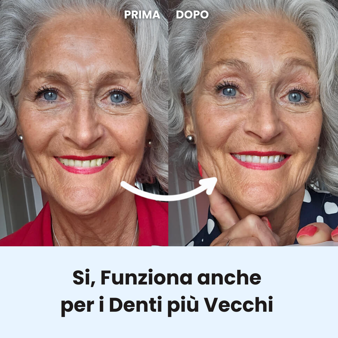 HappySmile - Polvere Dentale Remineralizzante